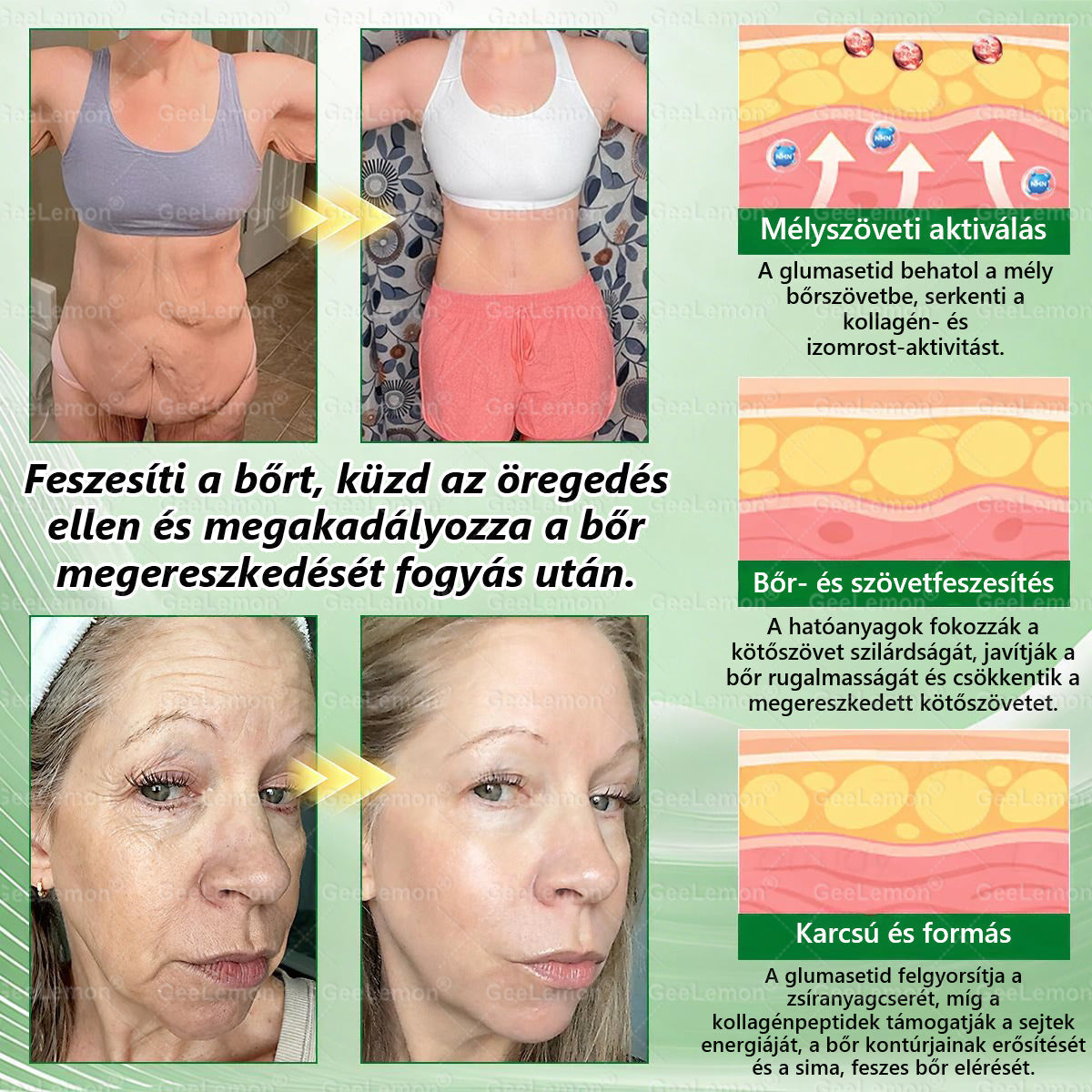 Ajánlott a Semmelweis Kórház által · 👩⚕️BENU hivatalos üzlet| 🎁 𝐆𝐞𝑒𝐿𝑒𝐦𝐨𝐧® Glumasetide 8 az 1-ben Karcsú és Egészséges Nano Mikrotűs Tapasz