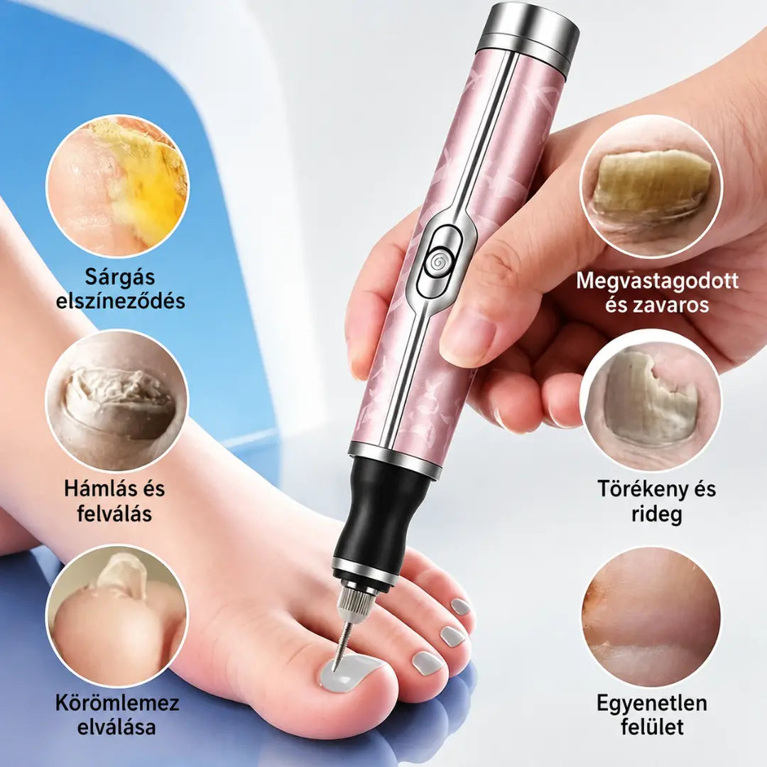 đ
đElektromos körömreszelĆ onychomycosis kezelĂ©sĂ©re