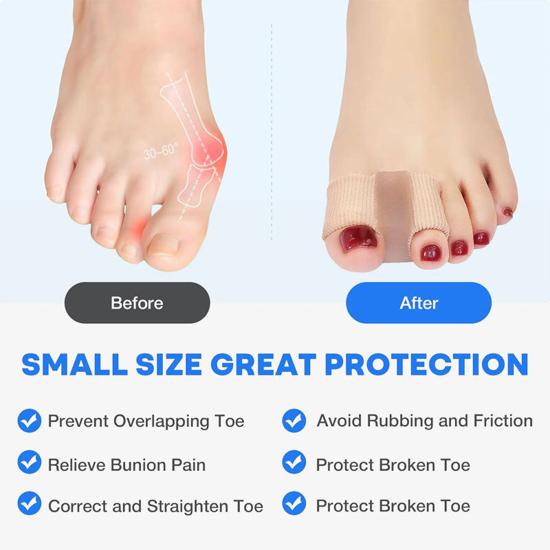 Lábujjszétválasztó és hallux valgus korrekció🦶