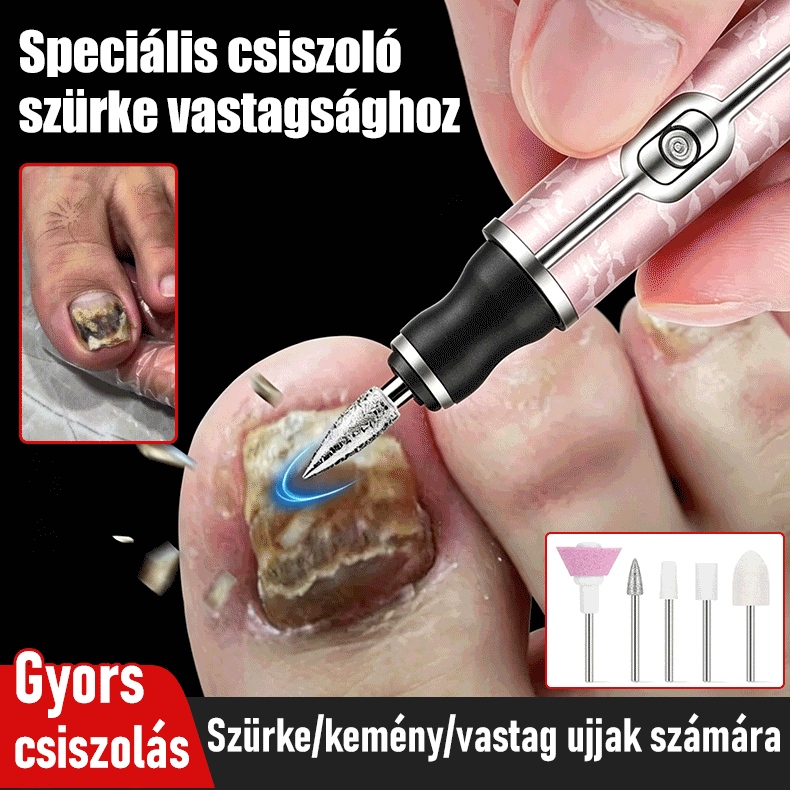 đ
đElektromos körömreszelĆ onychomycosis kezelĂ©sĂ©re