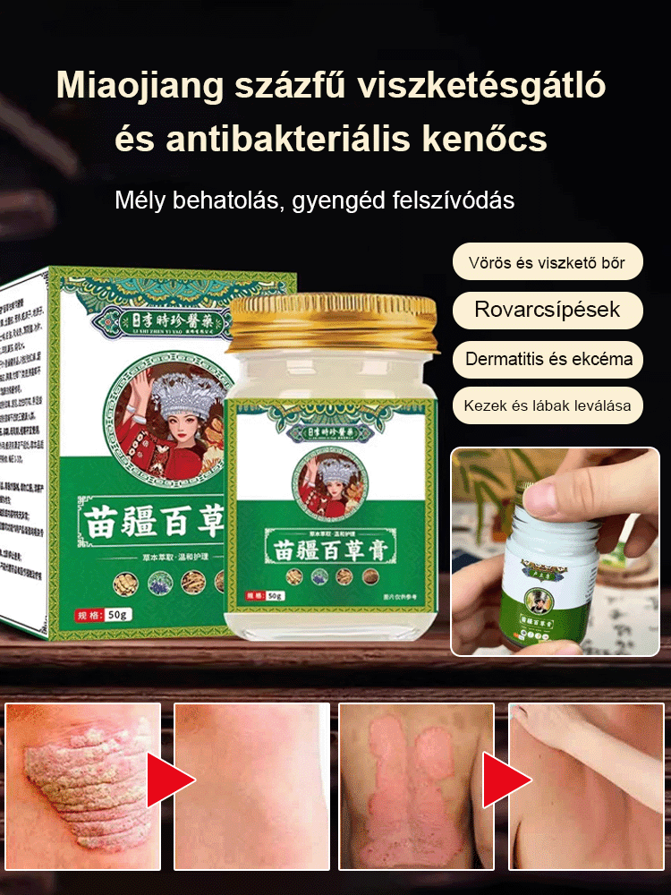 Miaojiang százfű viszketésgátló és antibakteriális kenőcs