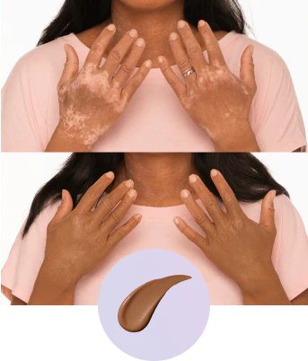 💜Utolsó nap – vegyél 1-et, kapsz 1-et ingyen!💜✨Body Perfector – vízálló, könnyű és hibátlan testfesték