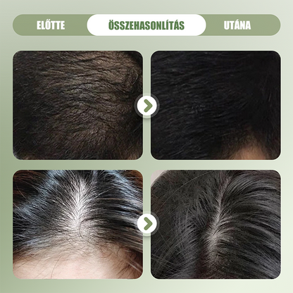 🌿 Természetes Sampon Bár Hajerősítéshez 🌱🥰