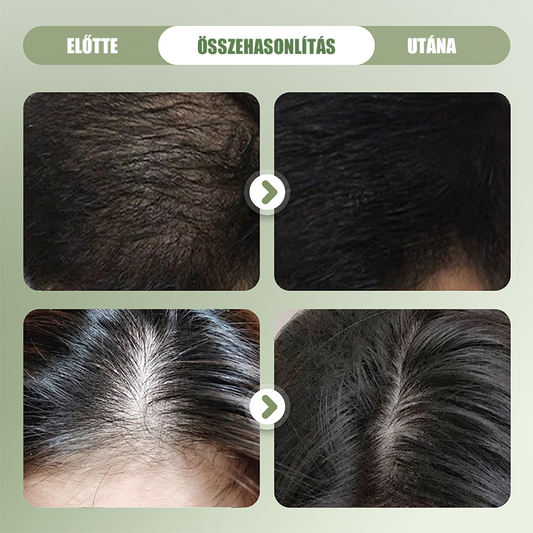 🌿 Természetes Sampon Bár Hajerősítéshez 🌱🥰