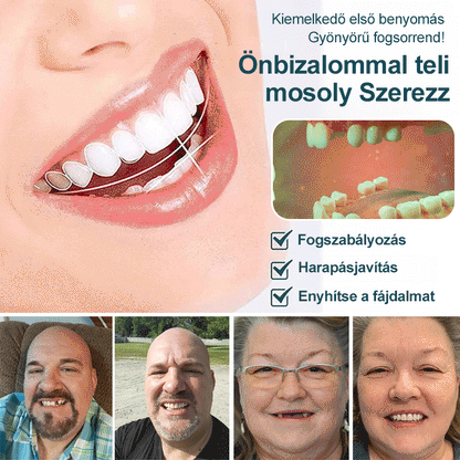 Tökéletes Mosoly Fogpótlás Készlet