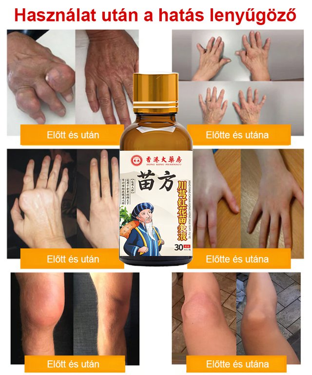 Chuanxiong és vörös virág külsőleges kezelő folyadék