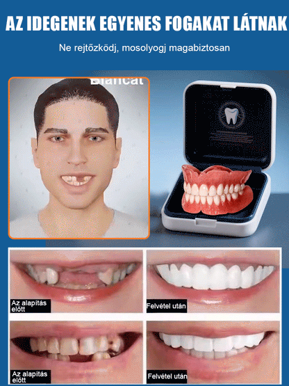 [Új brit kutatási eredmények] Szilikon szimulációs fogszabályozó fogszabályozó