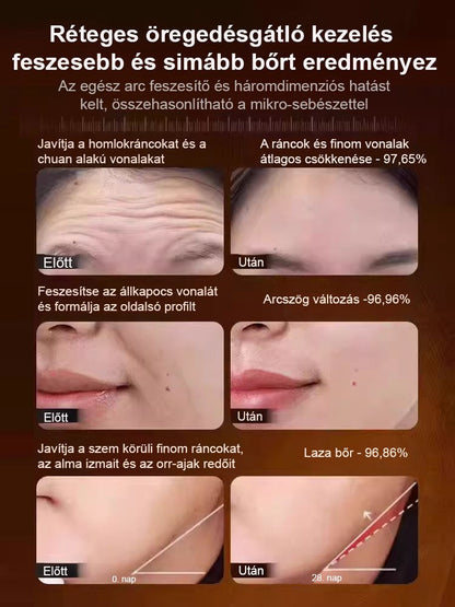 10 évvel fiatalabb egy másodperc alatt” ránctalanító krém