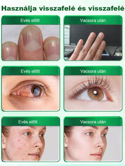 Víz Repülő Thistle kivonat májvédő kapszula