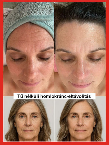 Lazac vízfény ránctalanító szérum -Egy érintéssel eltávolíthatja a ráncokat