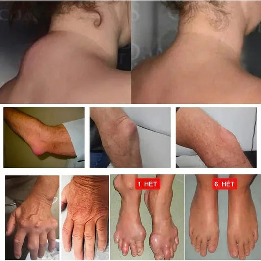 Kígyócsont öt méreg aranycsont olaj