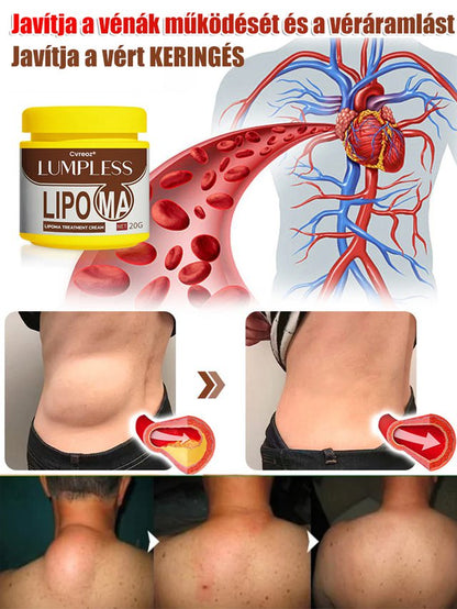 【Egy kenet és nem újul ki】Hét nap alatt eltünteti a lipómákat kenőcs