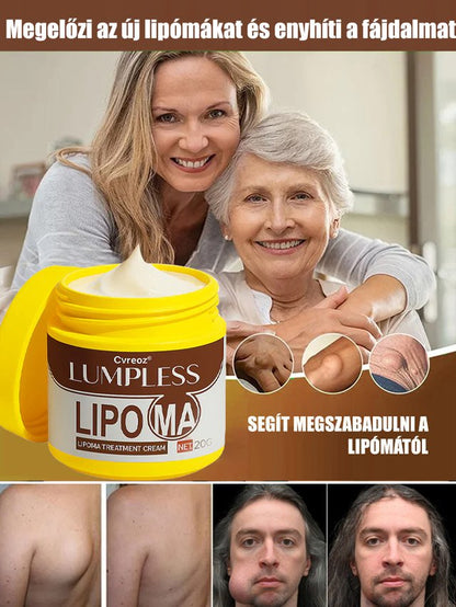 【Egy kenet és nem újul ki】Hét nap alatt eltünteti a lipómákat kenőcs