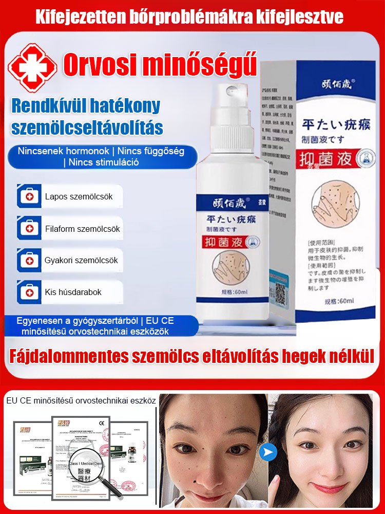 【A szemölcs eltávolítása nem ismétlődik】 Yi Baisui You Monkey antibakteriális folyadék