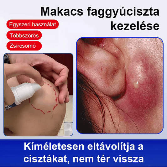 【Gyors hatású】Zsírkontroll kenőcs