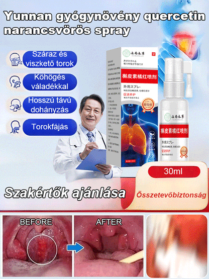 Yunnan gyógynövény quercetin narancsvörös spray