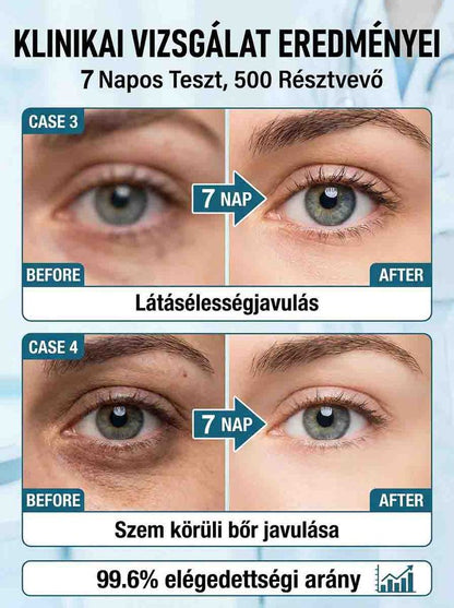 Fáradt szemek nyugtató ápoló permet