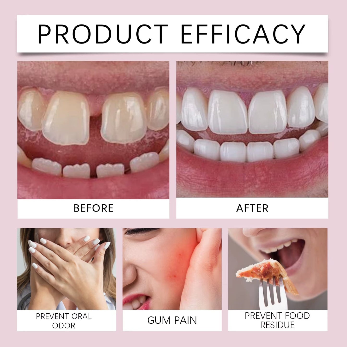 Nincs több kilazult fogsor! Európa legkelendőbb, tartós fogsorragasztója.🔥