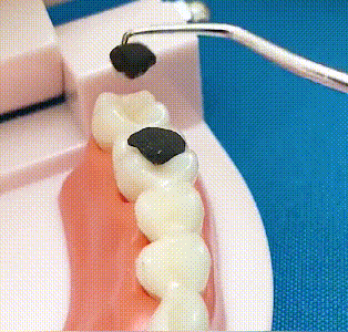 🦷Rozsdamentes acél fogpiszkáló készlet